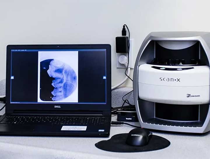 Digital Dental Radiology